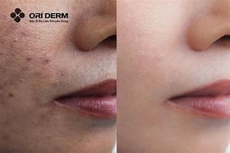 5625 6 VetThamTimOLST